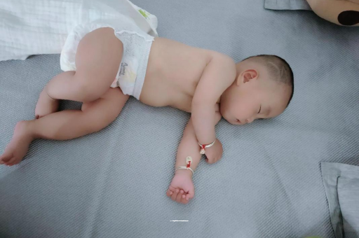 内江六个月宝宝眼睛散光